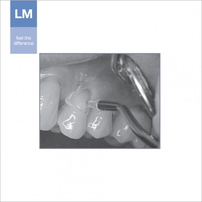 Cj Matriz Cervical