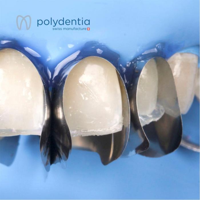 Unica Minideep Anteriores Refil 12pcs